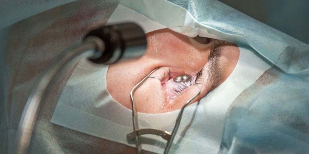Lasik eye surgery treatment at all for eyes hospital, vashi, navi mumbai